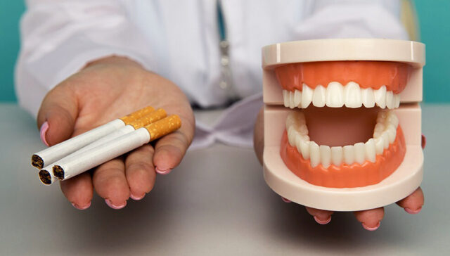 سیگار ایمپلنت